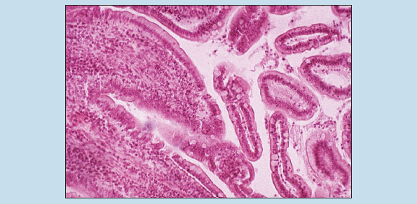 Slide image of simple columnar epithelium of duodenal villi at 50X magnification.