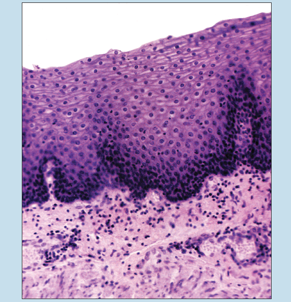 Slide image of stratified squamous epithelium of the esophagus at 50X magnification.