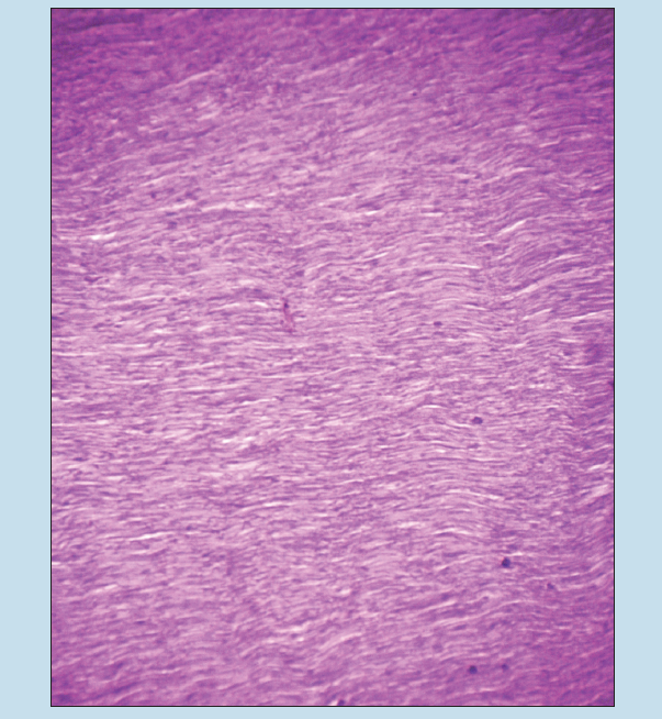 Microscope slide image of ligament (elastic type) (dense regular connective tissue) at 25X magnification.