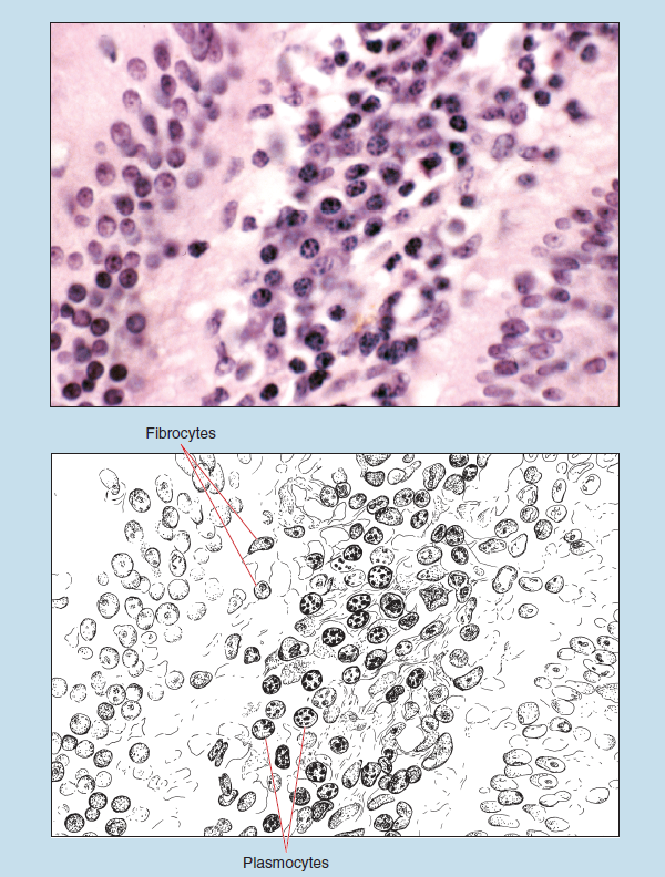 Two representations of loose, irregular connective tissue (lamina propria of duodenum) at 100X magnification. The upper image is a microscope slide, the lower is a sketch of the same tissue. The sketch is labelled to show fibrocytes and plasmocytes.