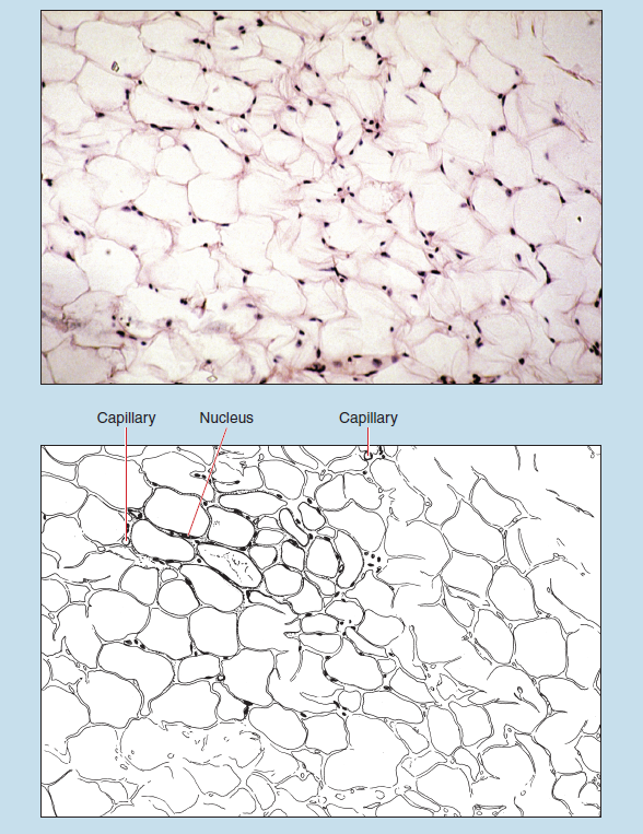 Two representations of white (unilocular) adipose tissue at 50X magnification. The upper image is a microscope slide, the lower is a sketch of the same tissue. The sketch is labelled to show two capillaries and a nucleus.