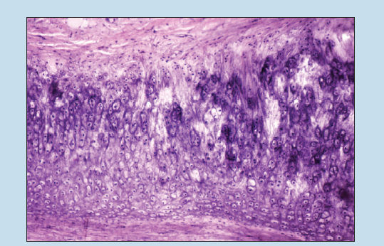 Figure 4-4 is a slide image of elastic cartilage (auricle of the ear) done with elastin stain at 50X magnification.