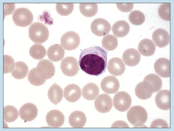 Figure 9-2 is a slide image of lymphocyte (Wright stain) at 350X magnification.
