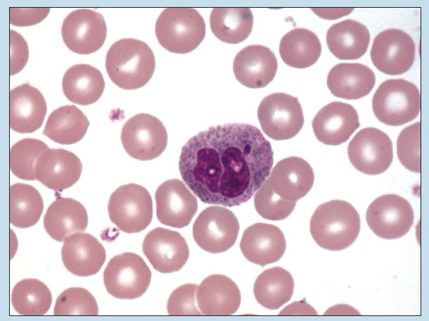 Figure 9-5 is a slide image of a basophillic granulocyte (Wright stain) at 350X magnification.