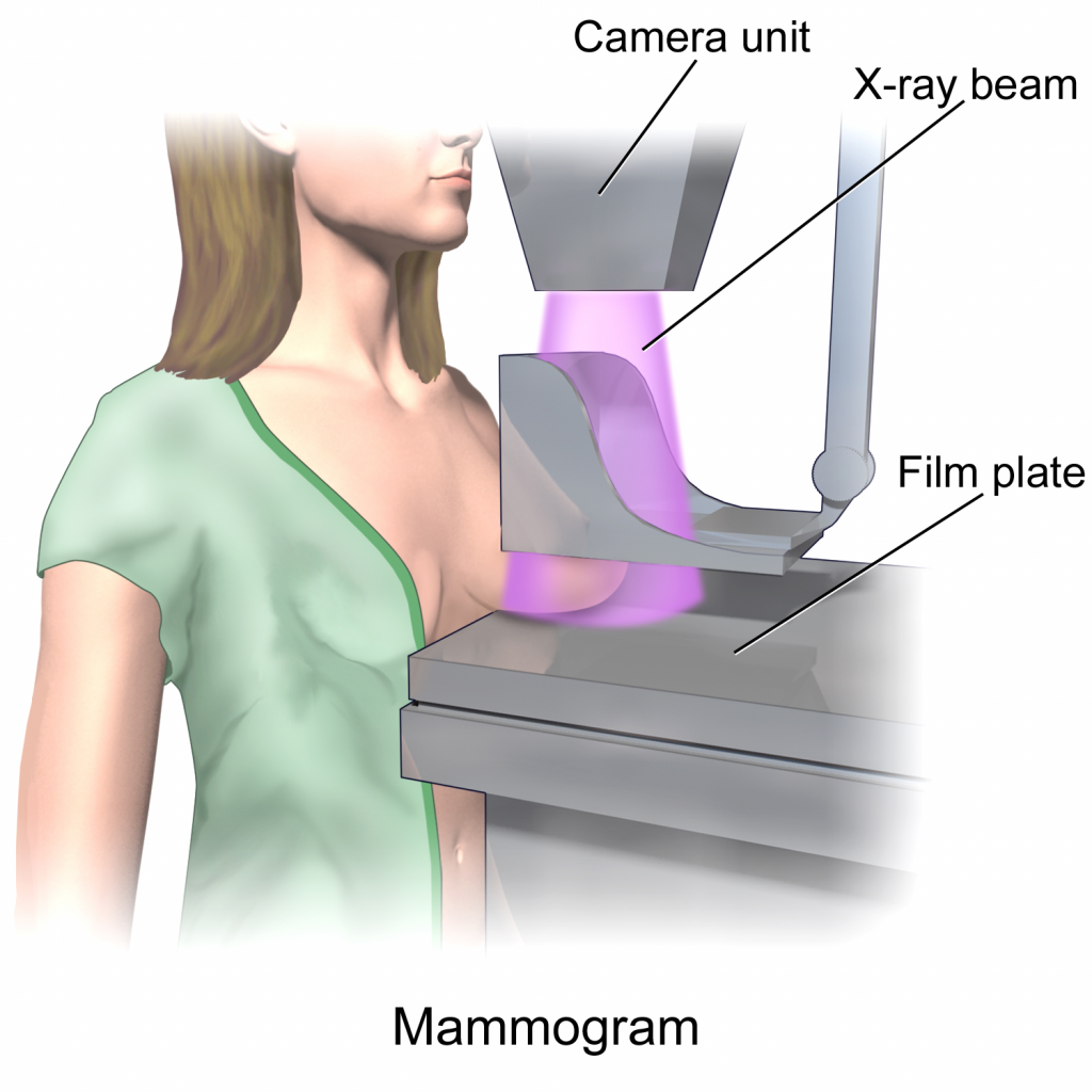 Mammography Undergraduate Diagnostic Imaging Fundamentals 3206