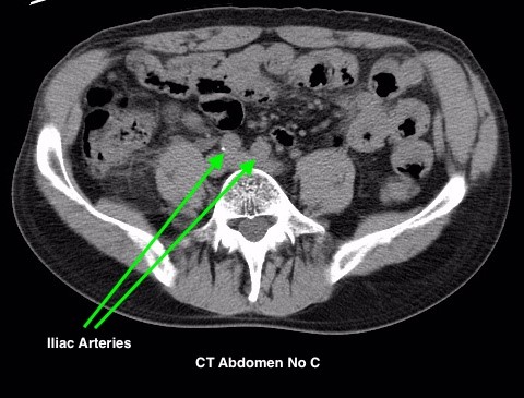 Gastrointestinal Contrast Media For CT Scan Study - RadTechOnDuty