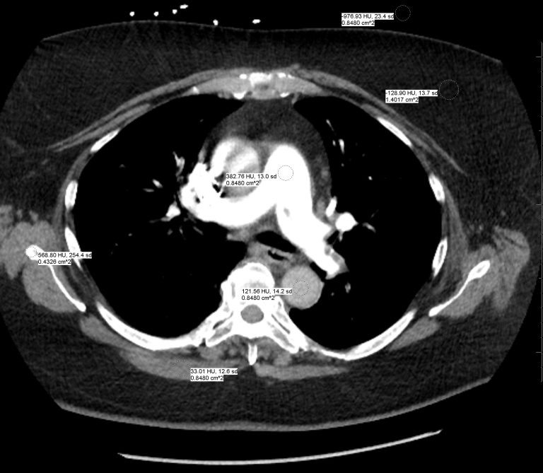 Computed Tomography Ct Undergraduate Diagnostic Imaging Fundamentals 4976