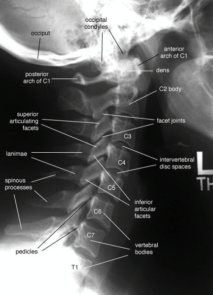 neck anatomy lateral radiography