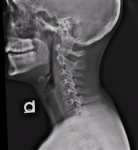 Cervical spine normal anatomy - sagittal view - Male – Medical Art