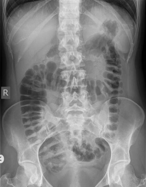 abdominal x ray case study