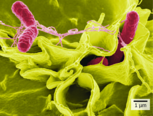 figure_03_03b-2 salmonella SEM