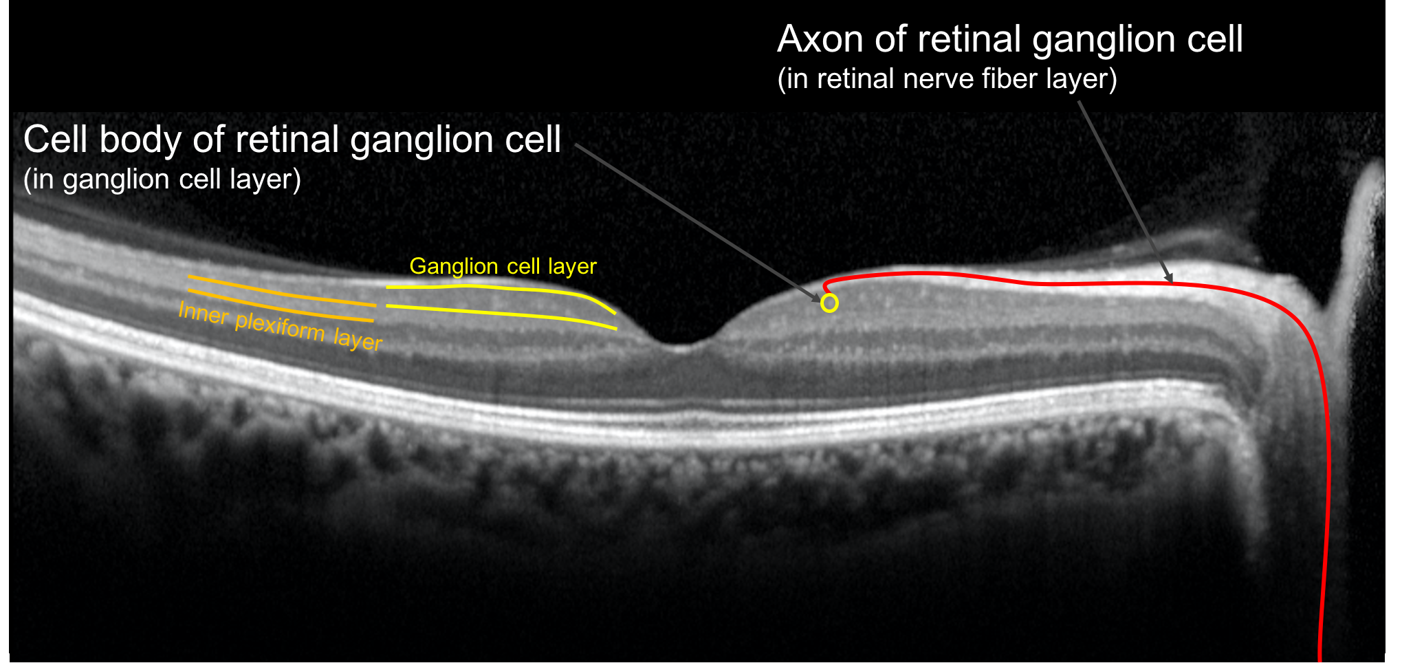 retinal layers oct