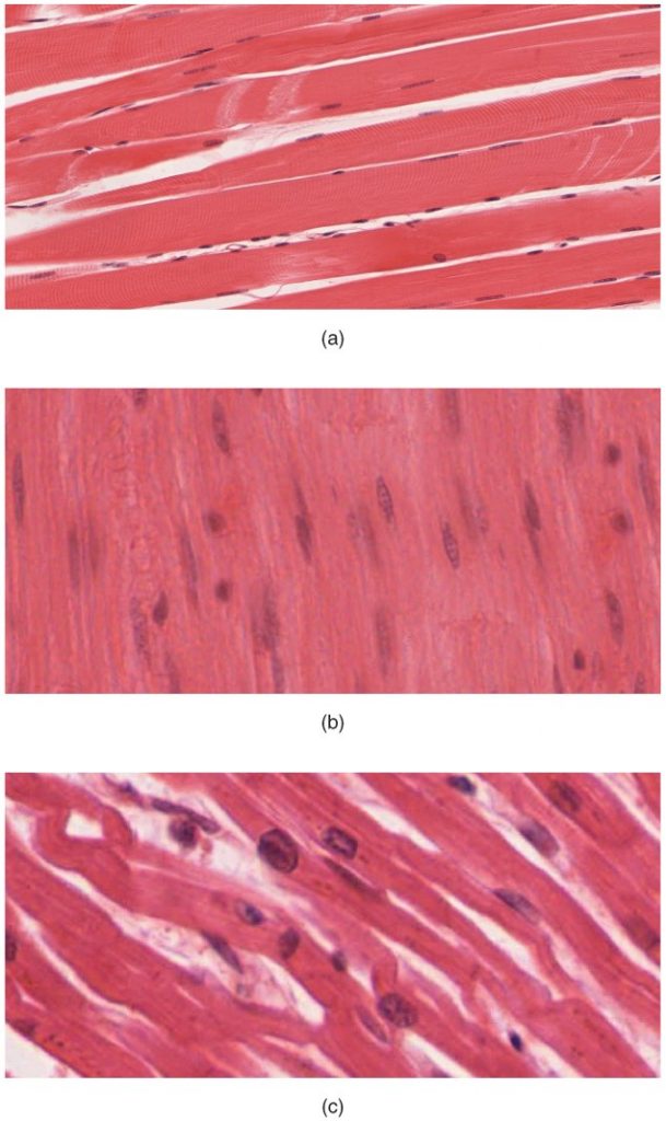 Photos of muscle tissue