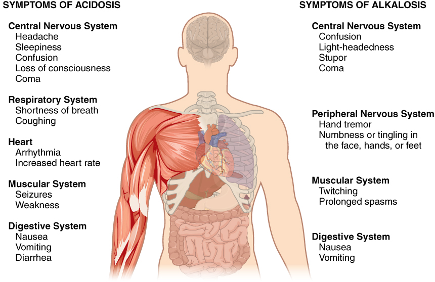 Symptoms of acidosis and alkalosis in diagram