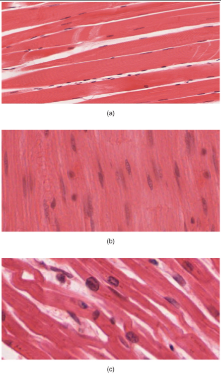 Three images of types of muscle tissue