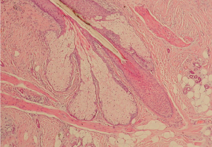 Cell image of hair follicle