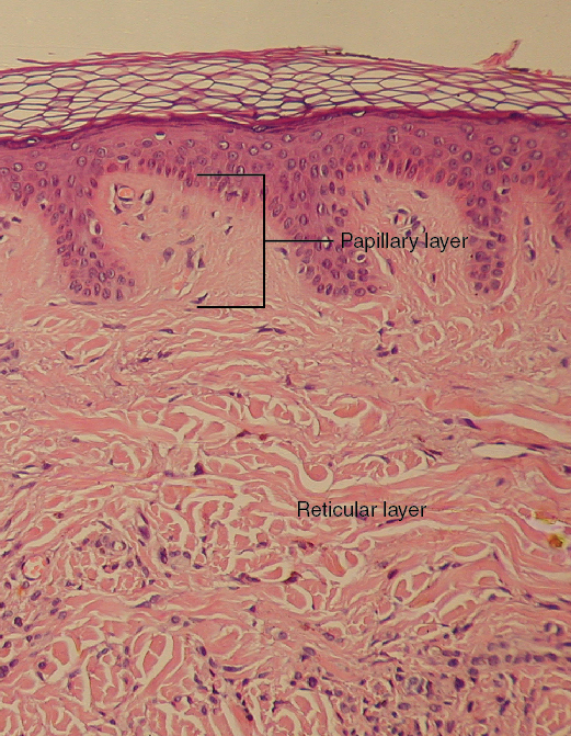 Diagram of layers of the dermis