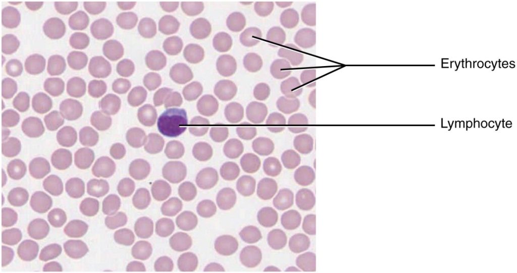 Image of blood