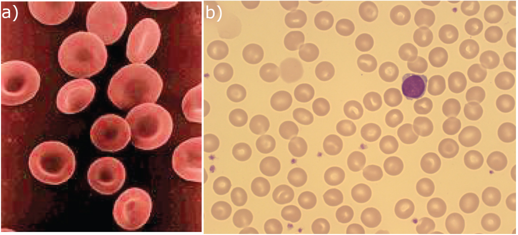 Images that show the shape of red blood cells