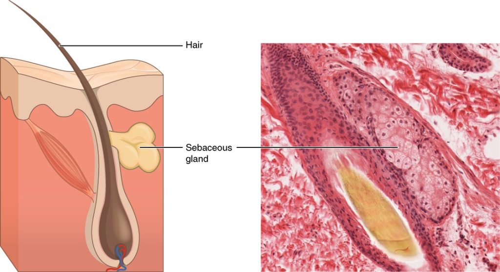 Diagram and image of sebaceous glands
