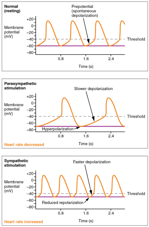 Graph on Effects of parasympathetic and sympathetic stimulation on normal sinus rhythm.