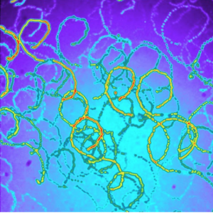 Magnetic Nanoparticles for Clinical Diagnostics and Therapy