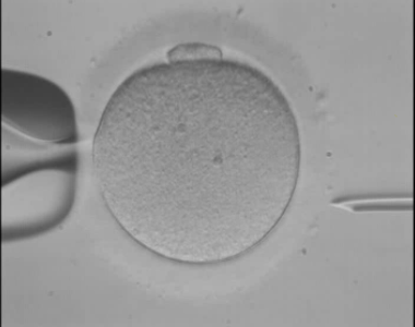 In vitro fertilization