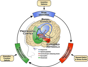 Image identifying which parts of the brain are influenced by alcohol at which stage of Alcohol Use Disorder as outlined in the text