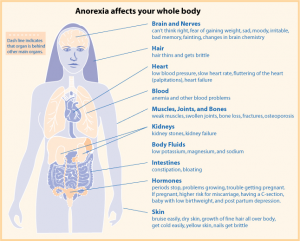 Anorexia causes hair loss, heart palpitations, brain fog, loss of muscle mass, joint issues, reduced minerals, kidney problems, reduction in circulating hormones, intestinal issues such as diarrhea or constipation, and skin issues like bruising or sores that don't heal