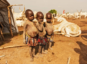 Photo of three small Sudanese girls with distended bellies indicating kwashiorkor.
