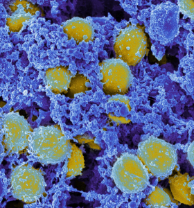 Electron microscope photo of Staphylococcus aureus