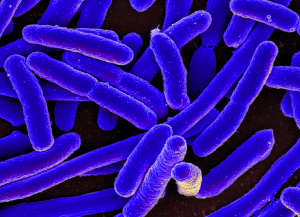 Electron microscope photo of Escherichia coli