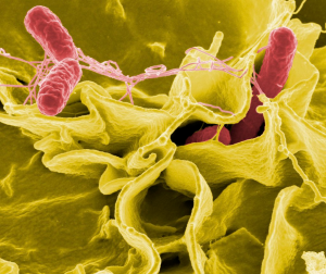 Electron microscope photo of salmonella