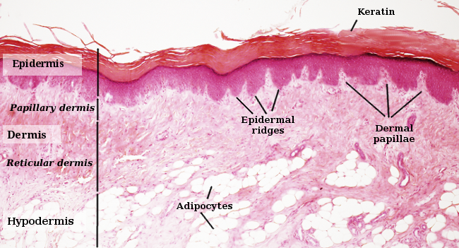 Thick skin showing epidermis and dermis