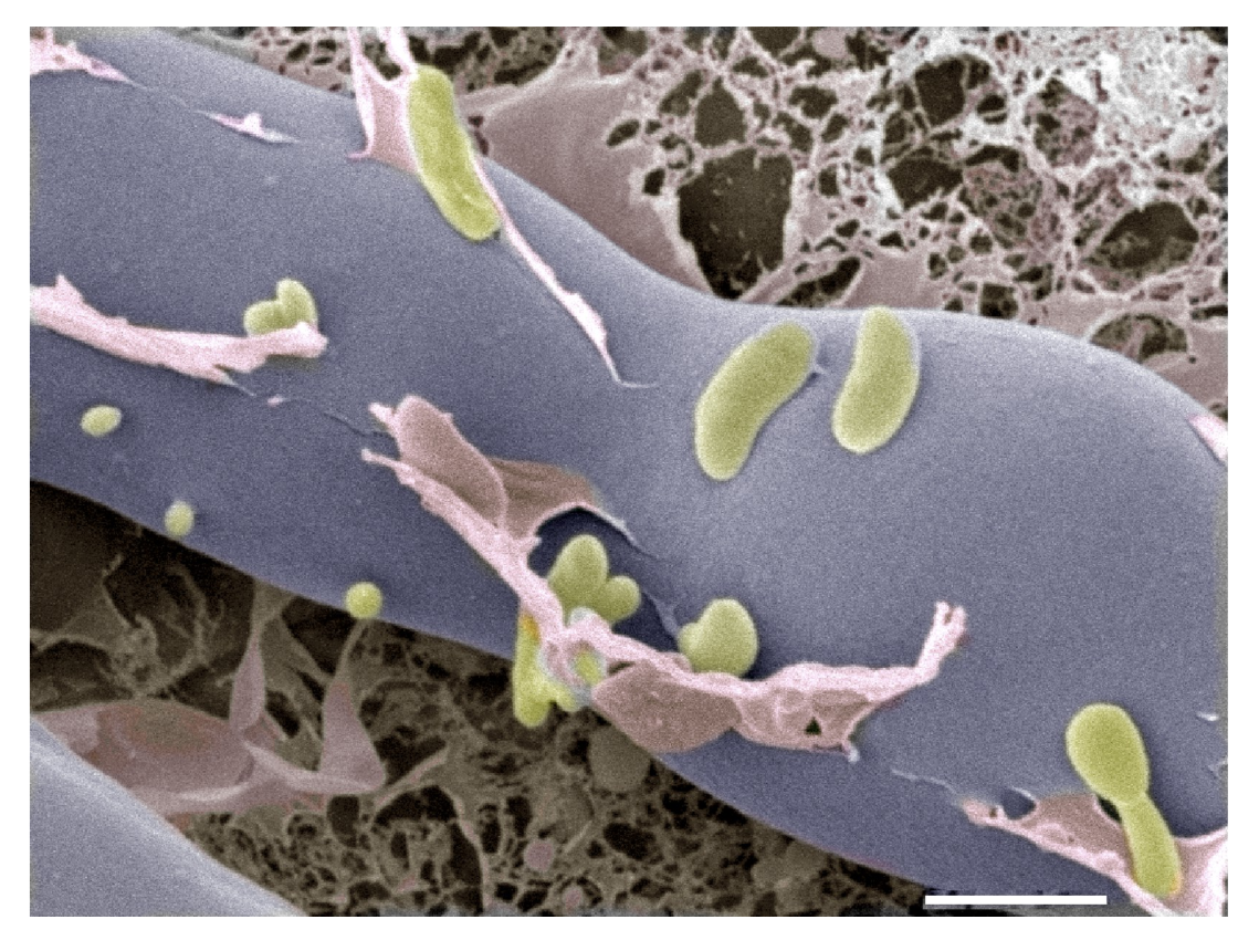 An elongated fungal cell is shown that takes up most of the space in the image. Small bacterial cells are scattered on the surface of the fungal cell.