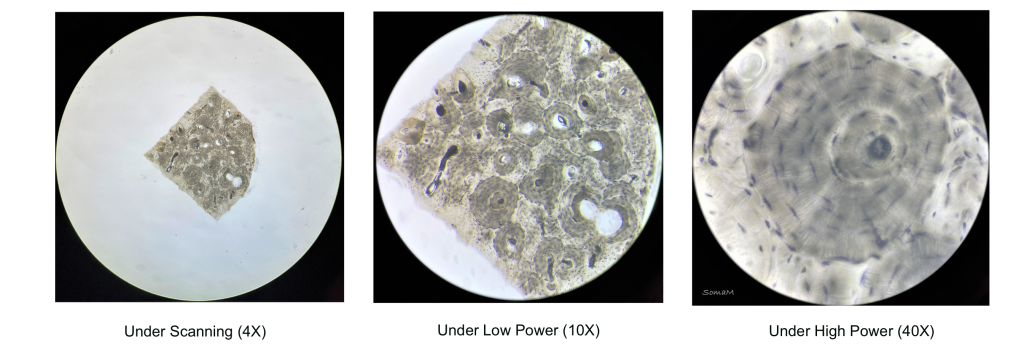 Osseous tissue under varied magnification power - scanning power (4x objective, left), low power (10x objective, center), and high power (40x objective, right).