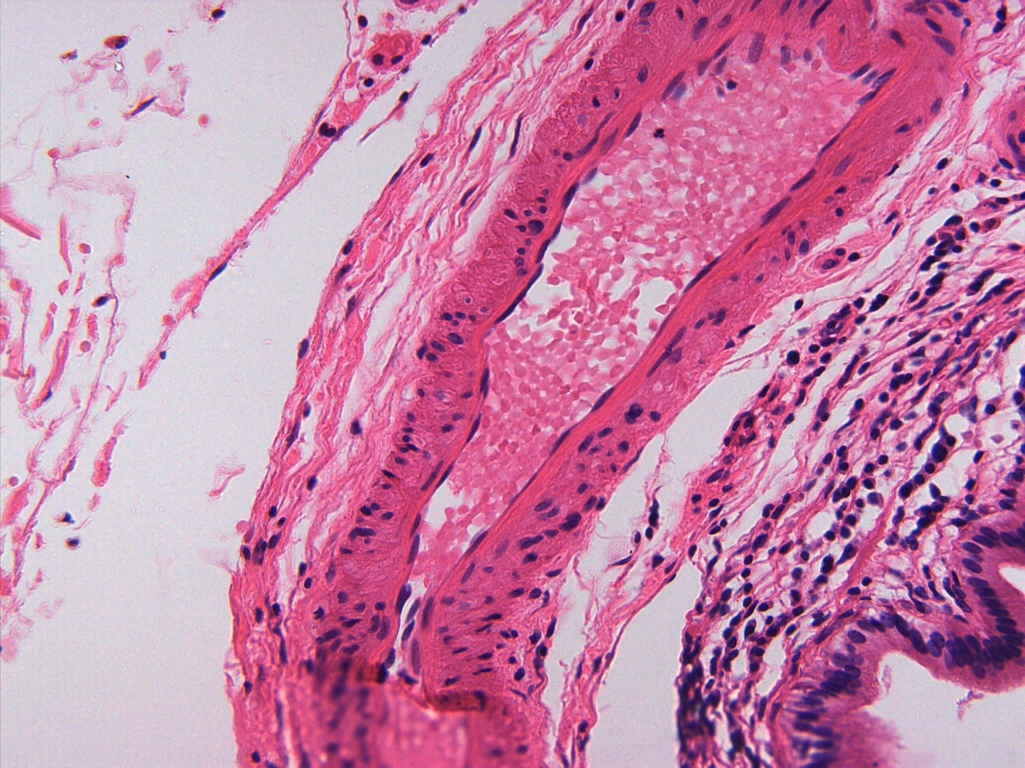 Simple Epithelial Tissues – Anatomy and Physiology I: An Interactive ...