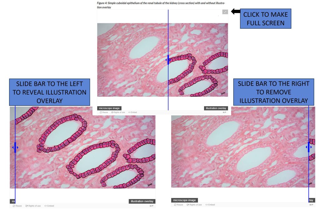 Using the interactive slide bar on microscope images with and without illustration overlay.