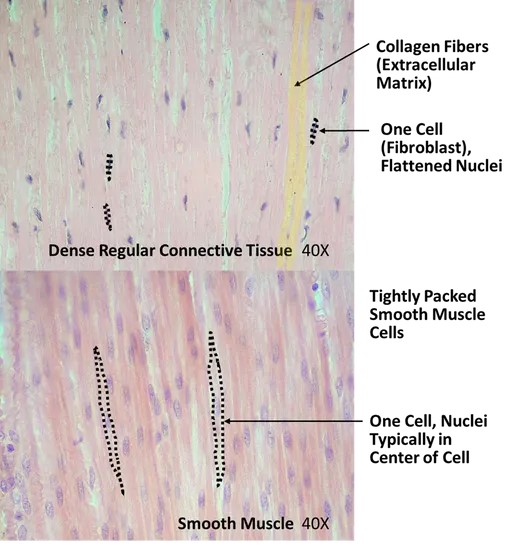 Comparison of dense regular connective tissue (top panel) with smooth muscle tissue (bottom panel)