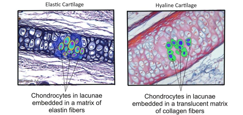 Compairson of elastic cartilage (left panel) with hyaline cartilage (right panel)