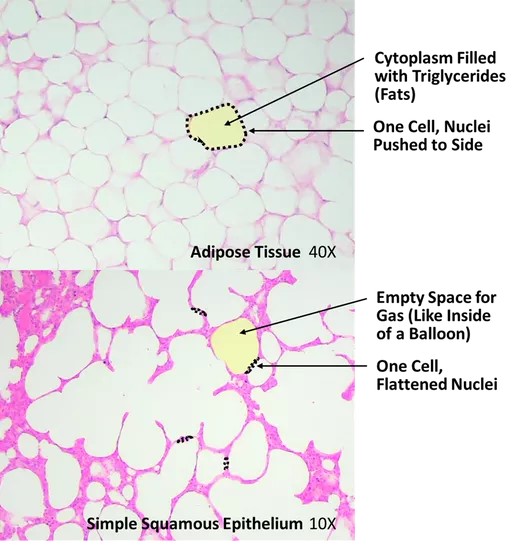 Comparison of adipose tissue (top panel) with simple squamous epithelium of the lung (bottom panel)