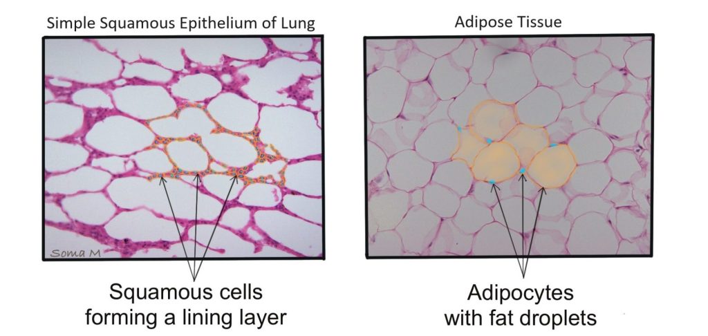 Comparison of simple squamous epithelium of the lung (left panel) with adipose tissue (right panel)