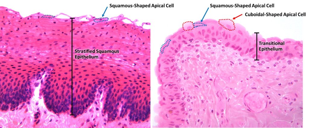 Comparison of stratified squamous epithelium (left panel) with transitional epithelium (right panel)