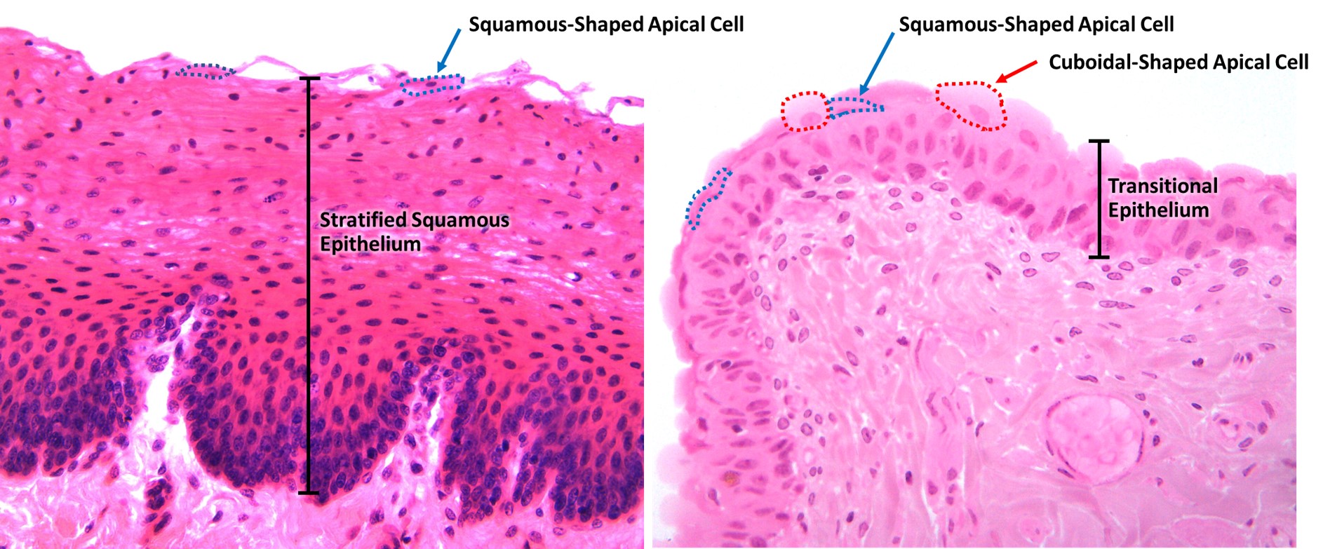 Tissue Type Look-Alikes – Anatomy and Physiology I: An Interactive ...