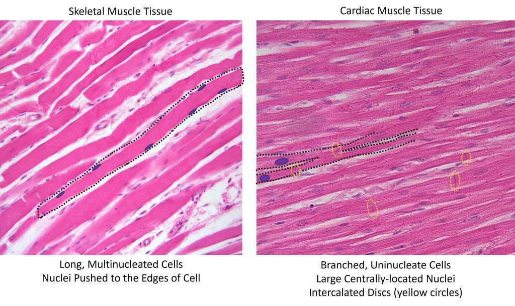 Comparison of skeletal muscle tissue (left panel) with cardiac muscle tissue (right panel)