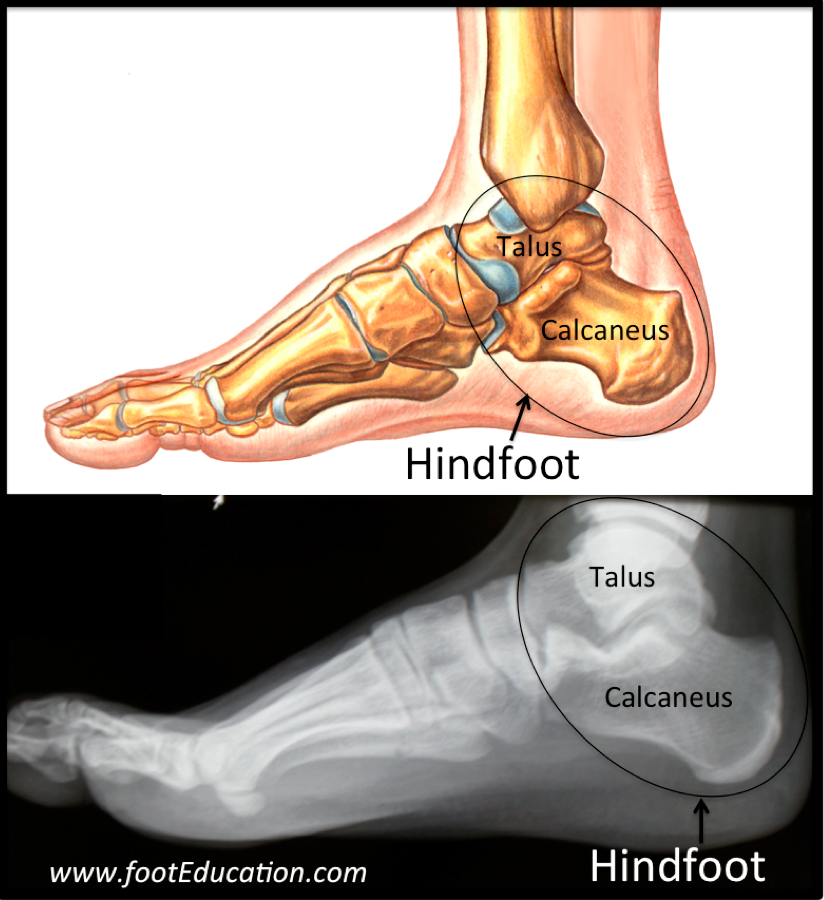 Calcaneus. Talus анатомия. Talus кость.