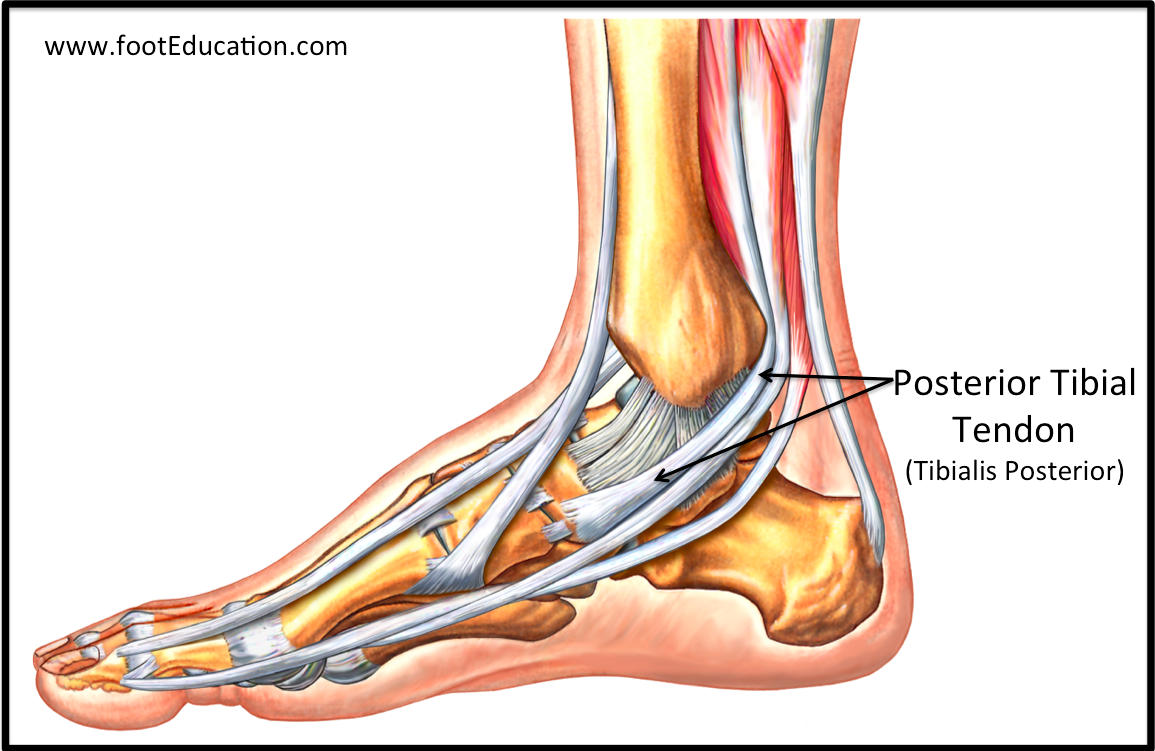 Tendon Disorders of the Foot and Ankle Orthopaedia Foot & Ankle