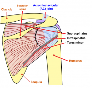 Disorders of the Rotator Cuff – Orthopaedia: Sports Medicine