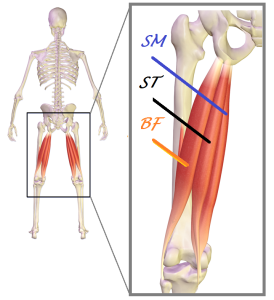 Tendon Disorders of the Hip and Thigh – Orthopaedia: Sports Medicine