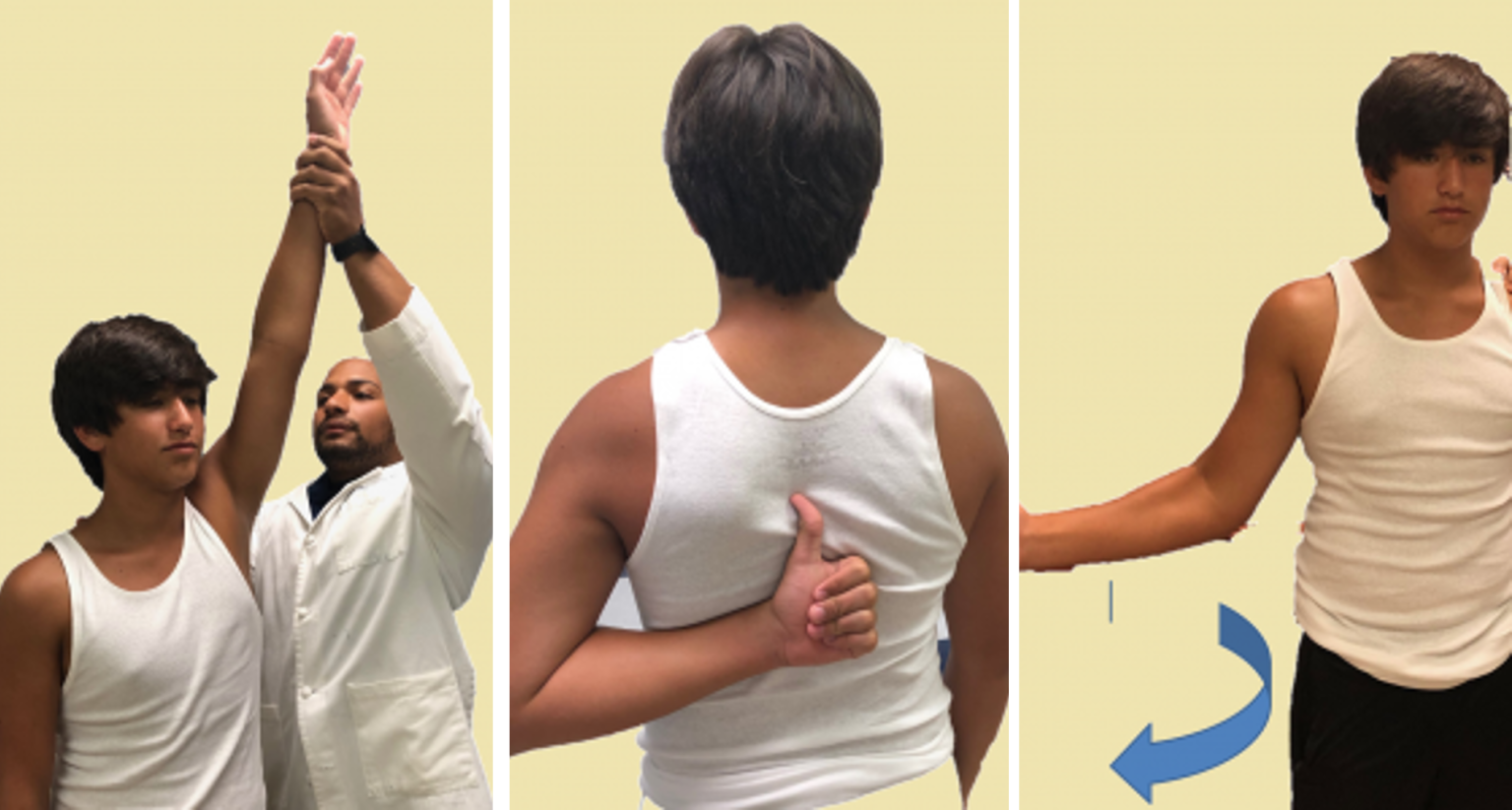 Adhesive Capsulitis Orthopaedia Sports Medicine